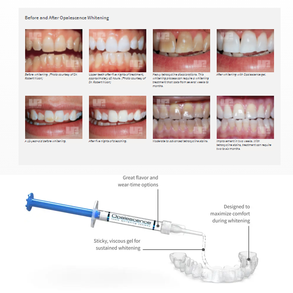 Opalescencia blanqueadora 20%  - Teeth Whitening Ulta reseña y precio