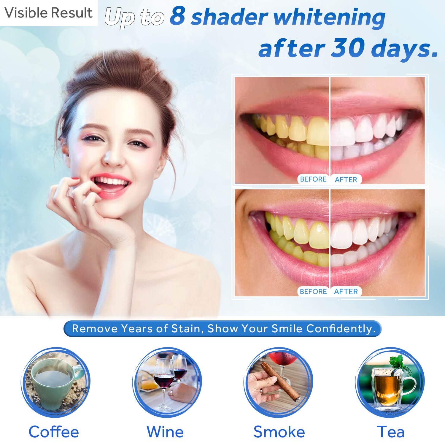 Jeringa de repuesto de Gel par - Teeth Whitening Ulta reseña y precio