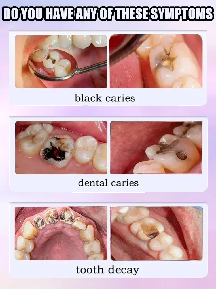Reparación de caries, reparaci - Teeth Whitening Charcoal Powder reseña y precio