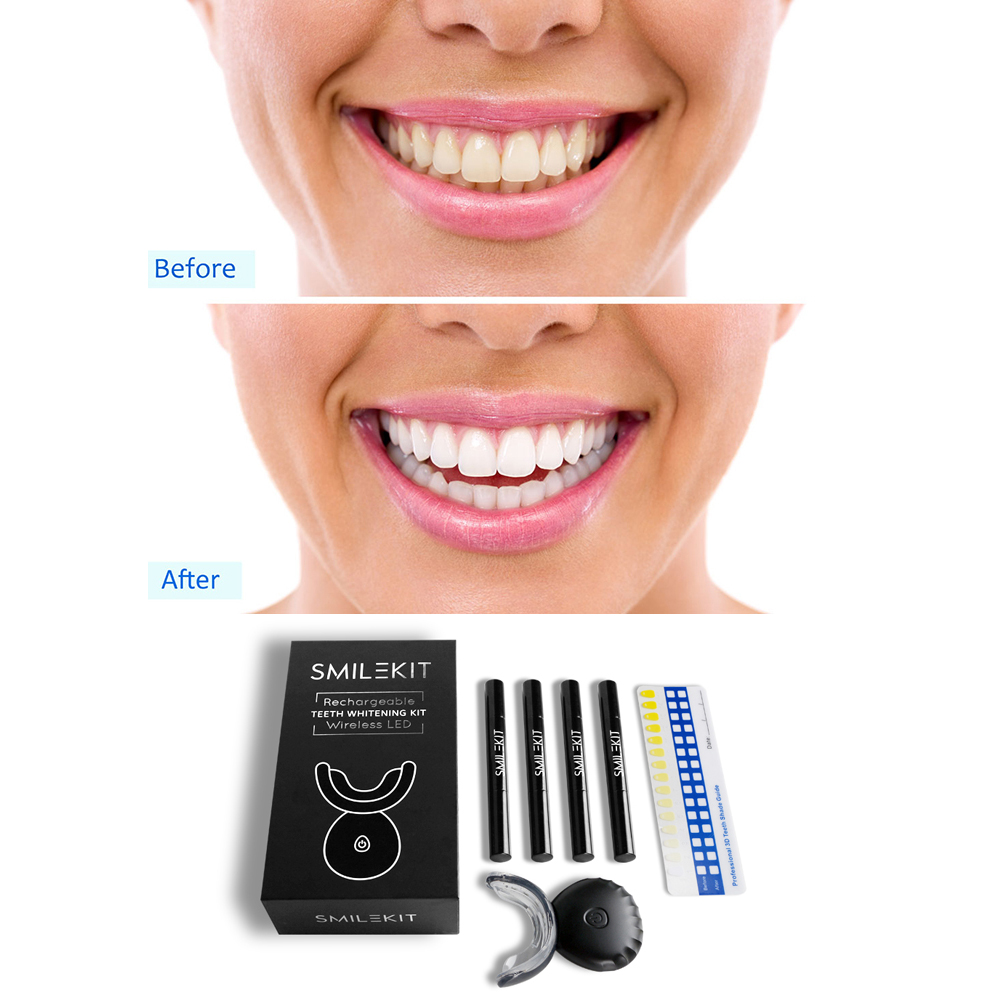 Kit de Gel blanqueador Dental  - Teeth Whitening Bleaching Kit reseña y precio