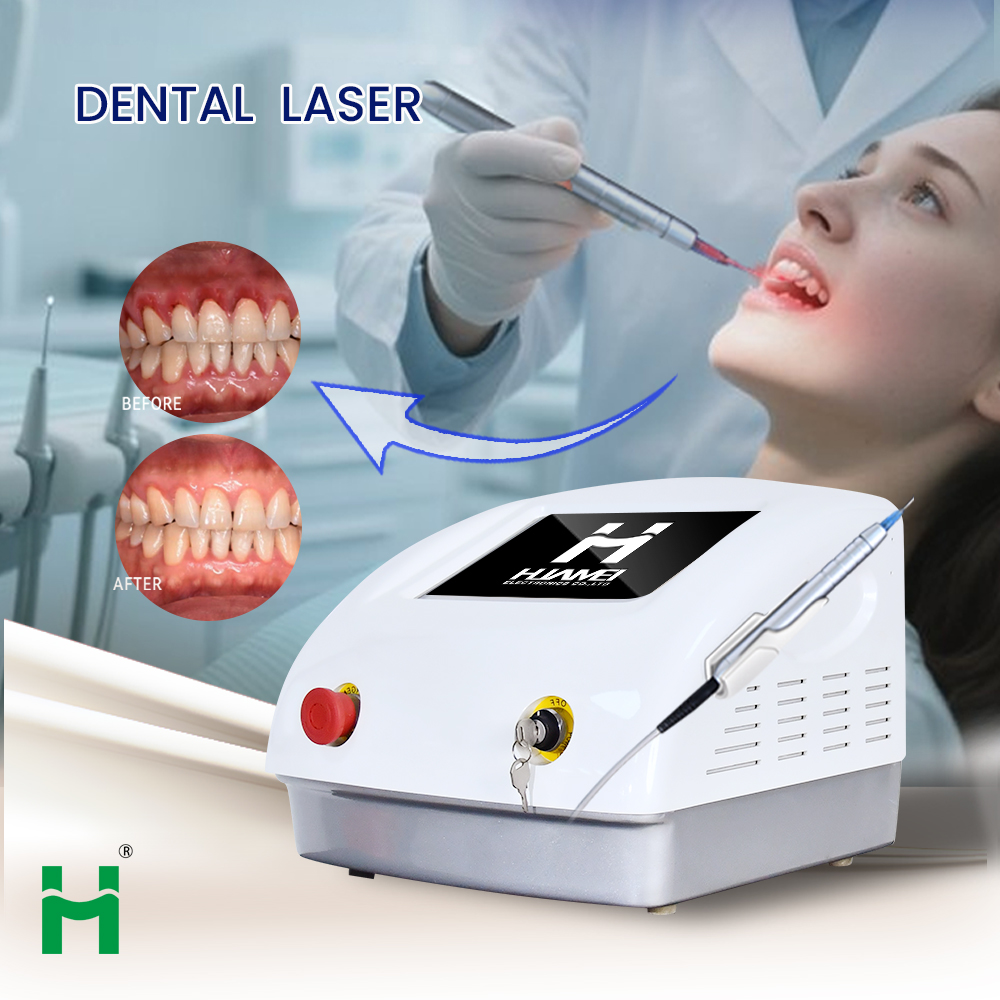 Kit Portátil de Blanqueamiento - Teeth Whitening Bleaching Kit reseña y precio